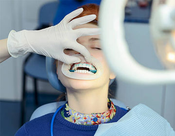 Teeth Whitening: Unfolding the Entire Procedure at Swastik Dental Clinic in Vadodara